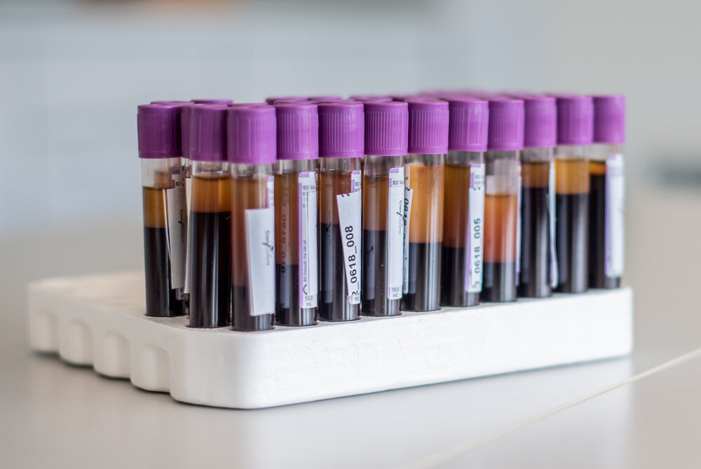 Blood samples